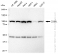 KD-Validated Anti-CSE1L Rabbit Monoclonal Antibody